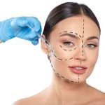 harmonização Facial