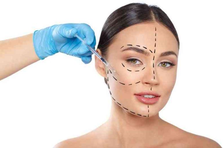 harmonização Facial