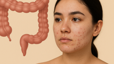 Inflamação intestinal